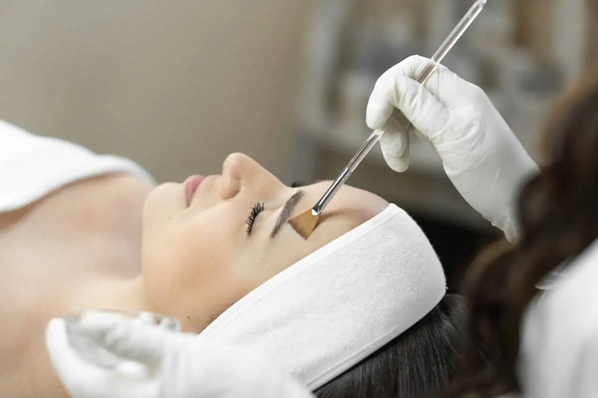 Chemical Peels for sensitivee skin